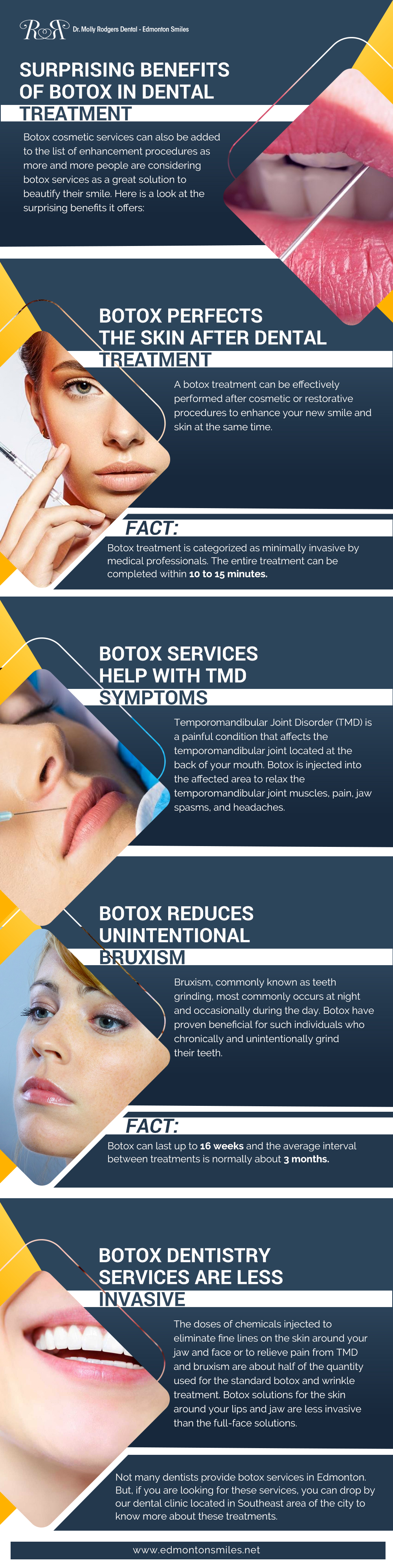 Botox Dental Treatment