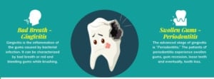 Common Dental Problems