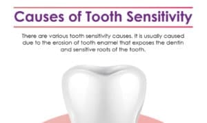 Tooth Sensitivity