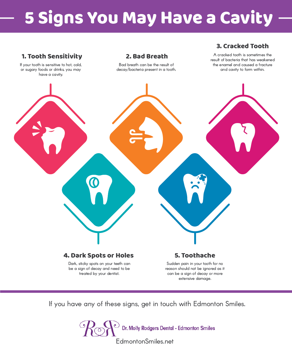 5 Signs You May Have A Cavity