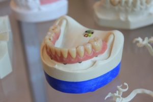 Demostrative False Teeth on a table