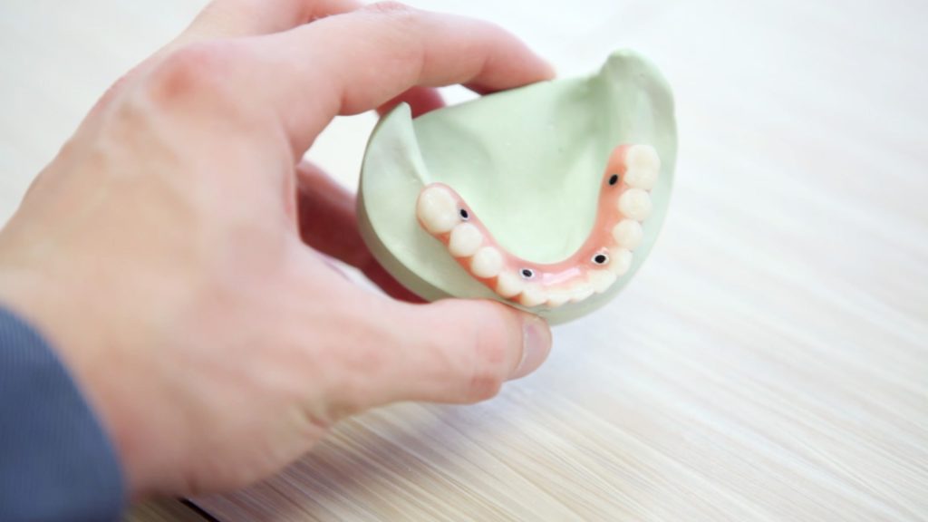 man holding a dental bridge model