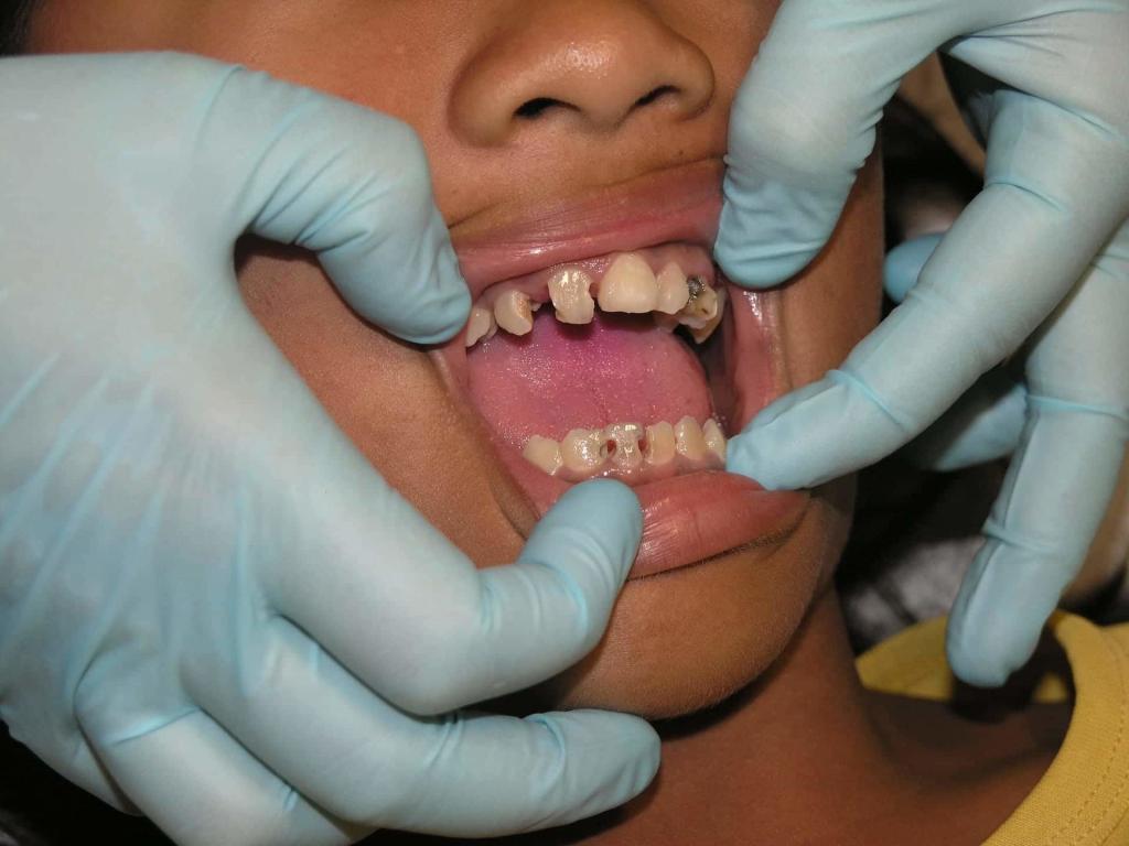 Child with dental issues