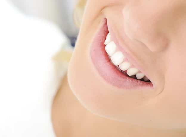 Porcelain Veneers Edmonton