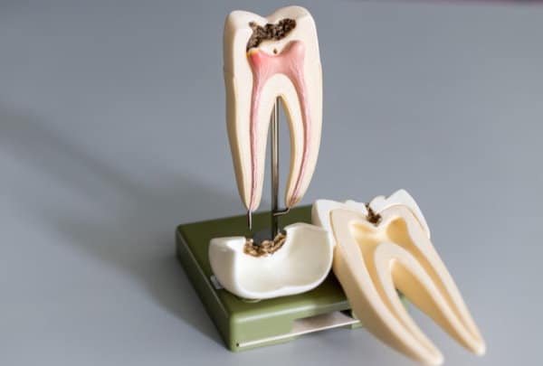 Dental Fee guide on root canal