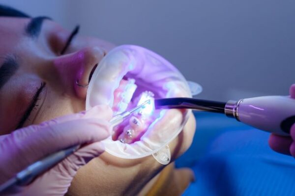 dental appliance is recommended for misaligned jaw due to teeth misalignment