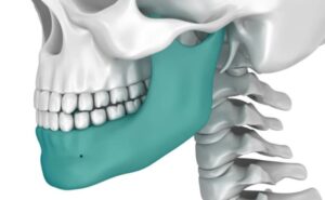 misaligned jaw treatment options