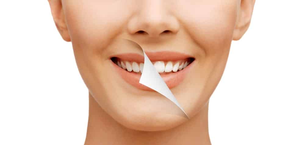 Teeth-whitening-myths-busted